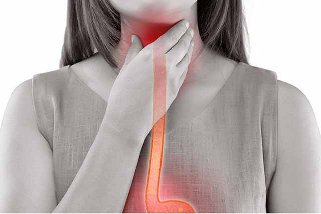 achalasia-